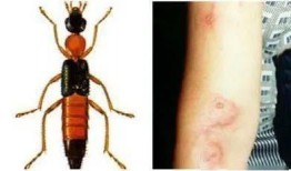 昆虫学者皮肤最新爆料蓝皮